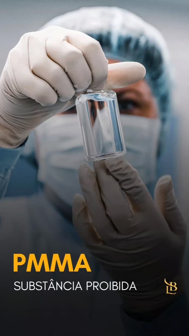 “Procedimentos rápidos”, promessas de volume imediato e preços atrativos podem esconder riscos extremamente graves.
O caso recente de uma paciente que morreu após uma harmonização de glúteos reacende um alerta importante sobre o uso de substâncias como o PMMA (polimetilmetacrilato) em procedimentos estéticos.

O PMMA NÃO é um preenchimento comum. Quando aplicado em grandes volumes — especialmente nos glúteos — pode causar complicações severas, como: • embolia pulmonar
• infecções graves
• necrose tecidual
• deformidades permanentes
• rejeição do organismo
• migração do produto
• e até risco de morte

Diferente da gordura do próprio paciente, o PMMA é um material permanente, de difícil remoção e que pode continuar causando reações anos depois da aplicação.

Antes de qualquer procedimento estético, pesquise: ✔ a formação do profissional
✔ o ambiente onde será realizado
✔ quais produtos serão utilizados
✔ e se existe segurança para lidar com complicações

Na estética, o “mais barato” ou o “resultado imediato” pode custar caro demais.